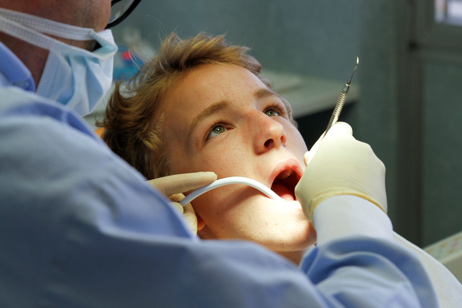 Detartrage-dentaire-montreal