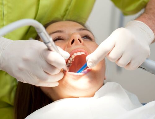 Examen de routine vs nettoyage dentaire : pourquoi les deux sont essentiels à Montréal