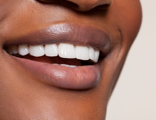 Teeth Whitening in Montreal: Complete Clinic vs. At-Home Guide