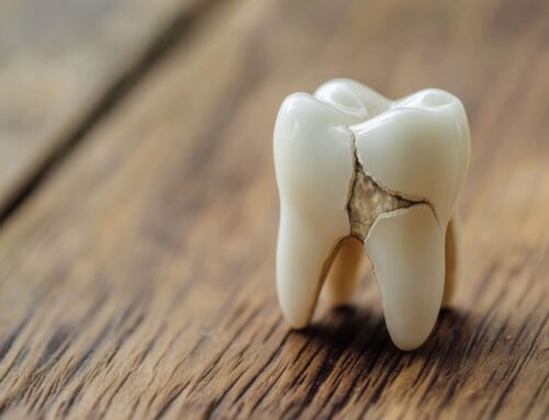 Dental Emergency in Montreal: What to Do in the First 60 Minutes